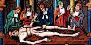 Medieval Doctors dissect a human body